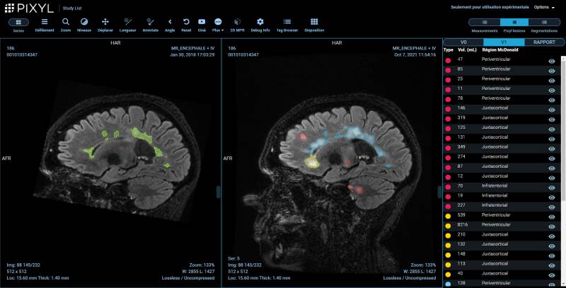 AI in medical imaging